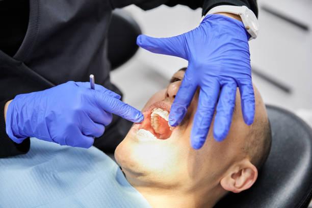 Best Emergency Dental Care for Sports Injuries in South Daytona, FL